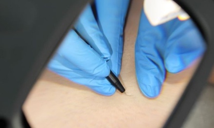 One 30-minute electrolysis session - Nios Electrolysis Permanent Hair Removal Center