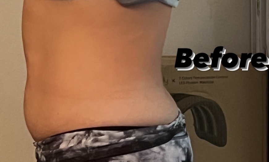 Image 3: Up to 45% Off on Spa / Salon Beauty Treatments at Bella Faccia Body Glow Esthetics