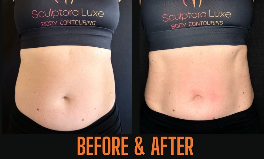 Image 7: Body Sculpting: Abs, Arms & Glutes (1–3 Sessions)