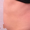 Image 10: Up to 62% Off on Lipo - Non-Invasive Laser-iLipo at Dolly's Beauty Enterprise