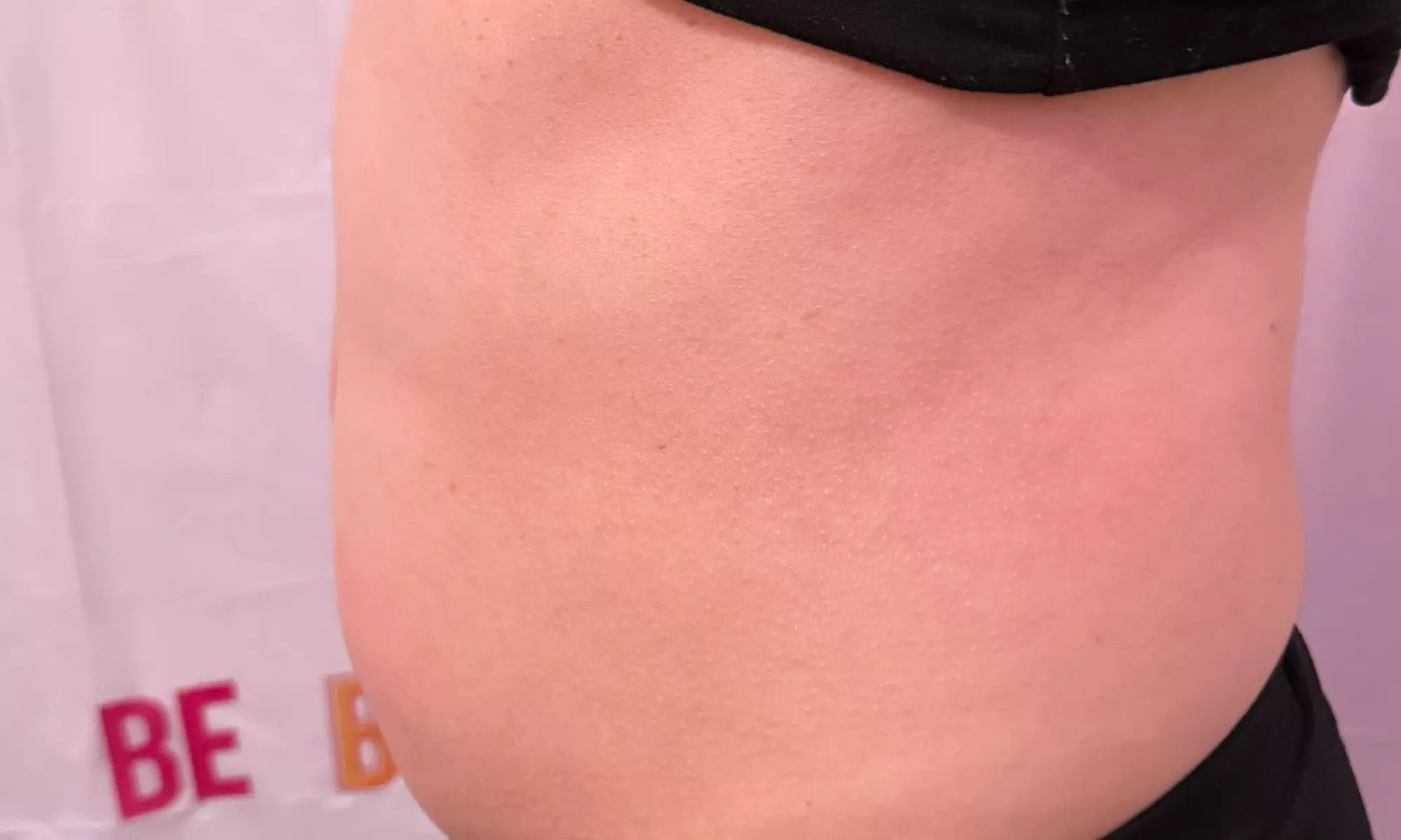 Up to 62% Off on Lipo - Non-Invasive Laser-iLipo at Dolly's Beauty Enterprise