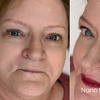 Image 1: Nano Hairstroke Brows, Ombre Brows, or Eyeliner Tattoo