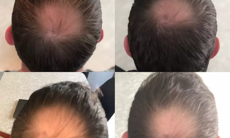 Up to 67% Off on Salon - Hair Straightening Treatment at UK Aesthetics Lounge