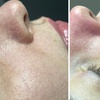 Image 1: Rejuvenate with Pampering Packages: Massages, Facials and More!