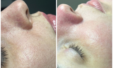  Pure Indulgence: Hand & Foot Bliss + Hydrating Glow Facial  - Secret Hands Med Spa by Zuleika