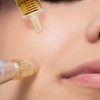 Image 3: One or Three Sessions of Skin or EMS Micro-Needling For Face or Neck