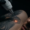 Image 1: Laser Hair Removal, Tattoo Removal, Carbon Peel, Acne Treatments