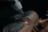Laser Hair Removal, Laser Tattoo Removal, Laser Carbon Peel, Laser Acne Treatments (Up to 60% Off)