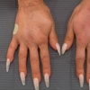 Image 2: One Syringe of Radiesse for Neck / Décolleté and Hand Rejuvenation at No Pain All Gain Spa (Up to 30% Off)