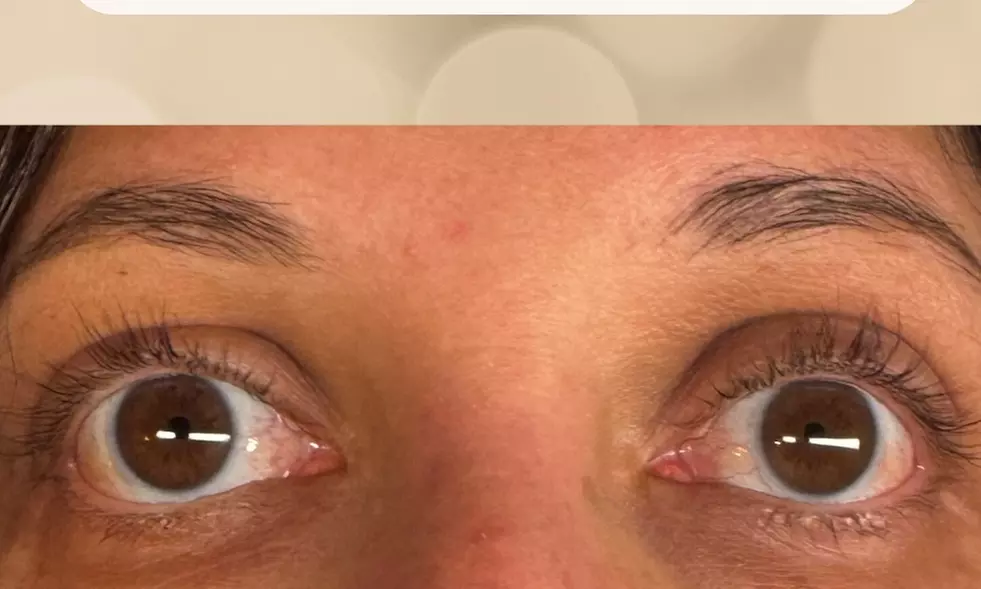 60-Minute Custom Glow Facials with Chemical Peel OR Dermaplanning