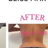 Image 1: Discover the Power of Venus Bliss:  Laser Lipolysis Treatments at Black Bella Dc Body Sculpting (Up to 40% Off)