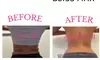 Discover the Power of Venus Bliss:  Laser Lipolysis Treatments at Black Bella Dc Body Sculpting (Up to 40% Off)