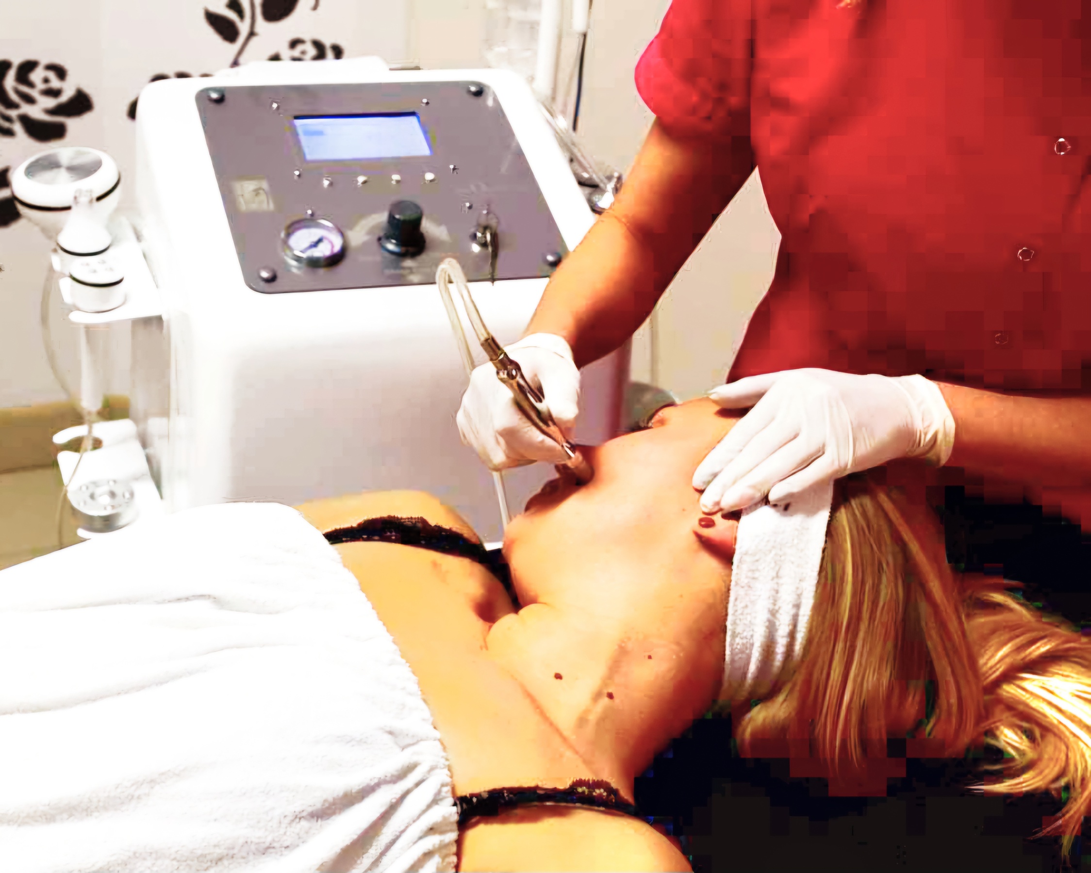 Mikrodermabrazja w firmie BEAUTY FACE Gabinet Kosmetologii Medycznej