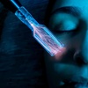 Image 5: Cold & Hot Plasma Fusion Rejuvenation for Youthful Skin