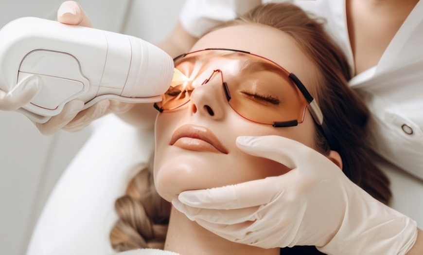 Image 1: Get One or Three Skin Brightening Laser Treatment (nd yag Laser) 