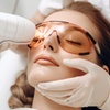 Image 1: Get One or Three Skin Brightening Laser Treatment (nd yag Laser) 