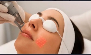 Laser Genesis Skin Renewal /Rejuvenation and Tightening Treatment with Oxygen Therapy