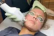 Non-Ablative Fractional Laser - LaseMD Ultra for Stretch Marks, Face, Neck, or Hands at Loma Laser (Up to  45% Off) - Second Medium