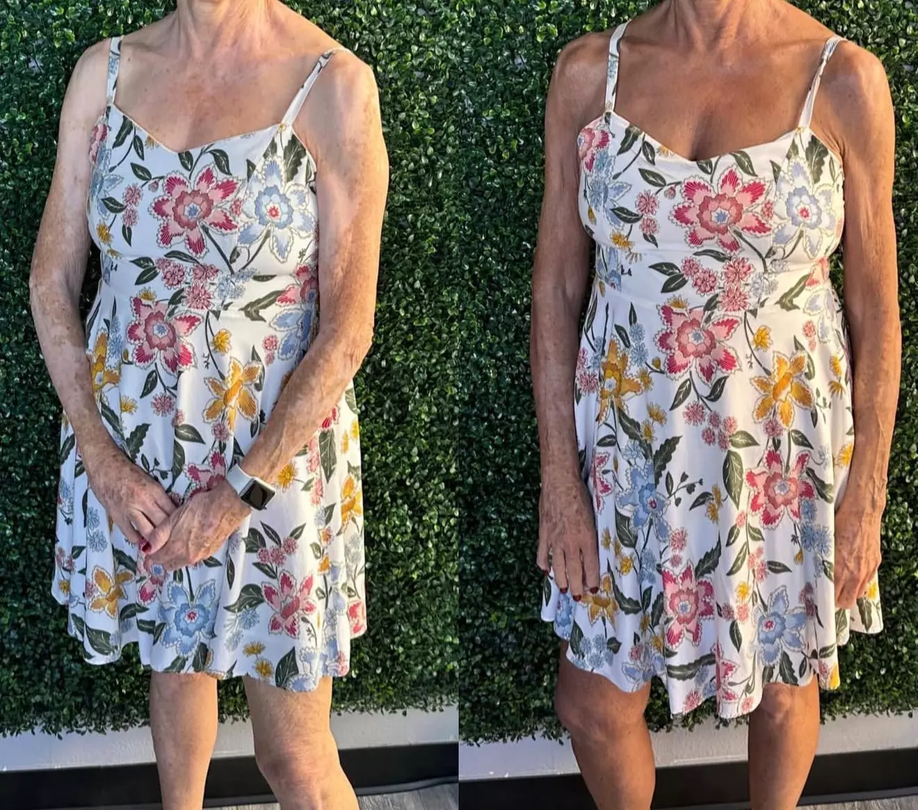 Two or Four Custom Spray-Tan Sessions or One Custom Air Brush Tan