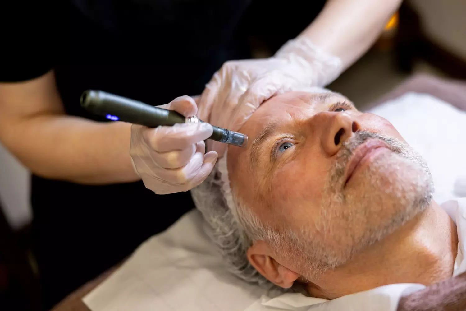 Achieve Youthful Glow with Temecula Hormone And Aesthetics' Microneedling Treatments, offering up to 80% off - Primary Image