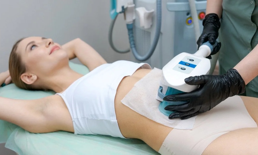Image 7: Discover Transformative Body Contouring with One or Two CoolSculpting at St. Jude Medical Center (Up To 77% Off)