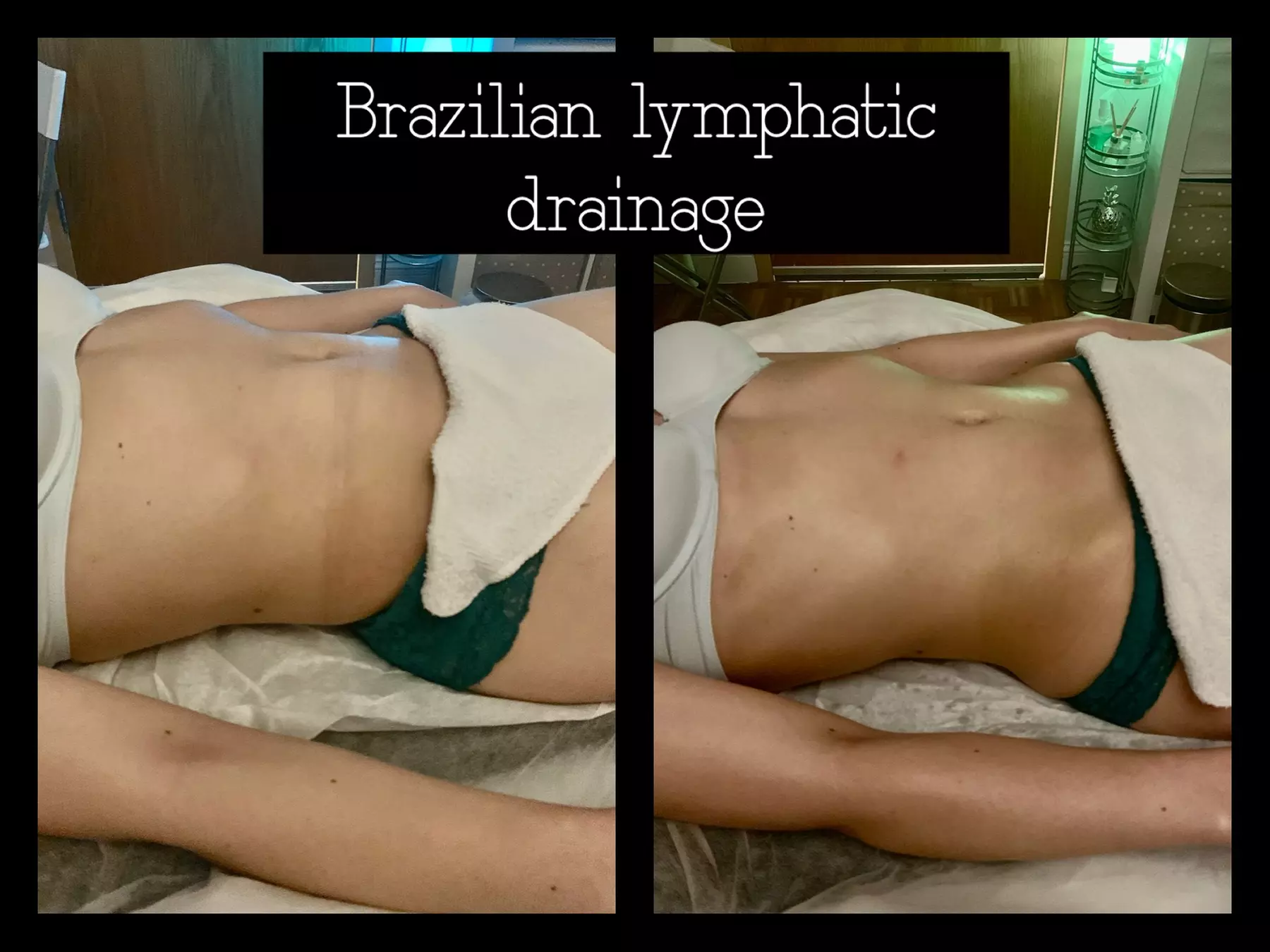 Up to 47% Off on Lymphatic Drainage Massage at Brazilian Beauty NYC - Primary Image