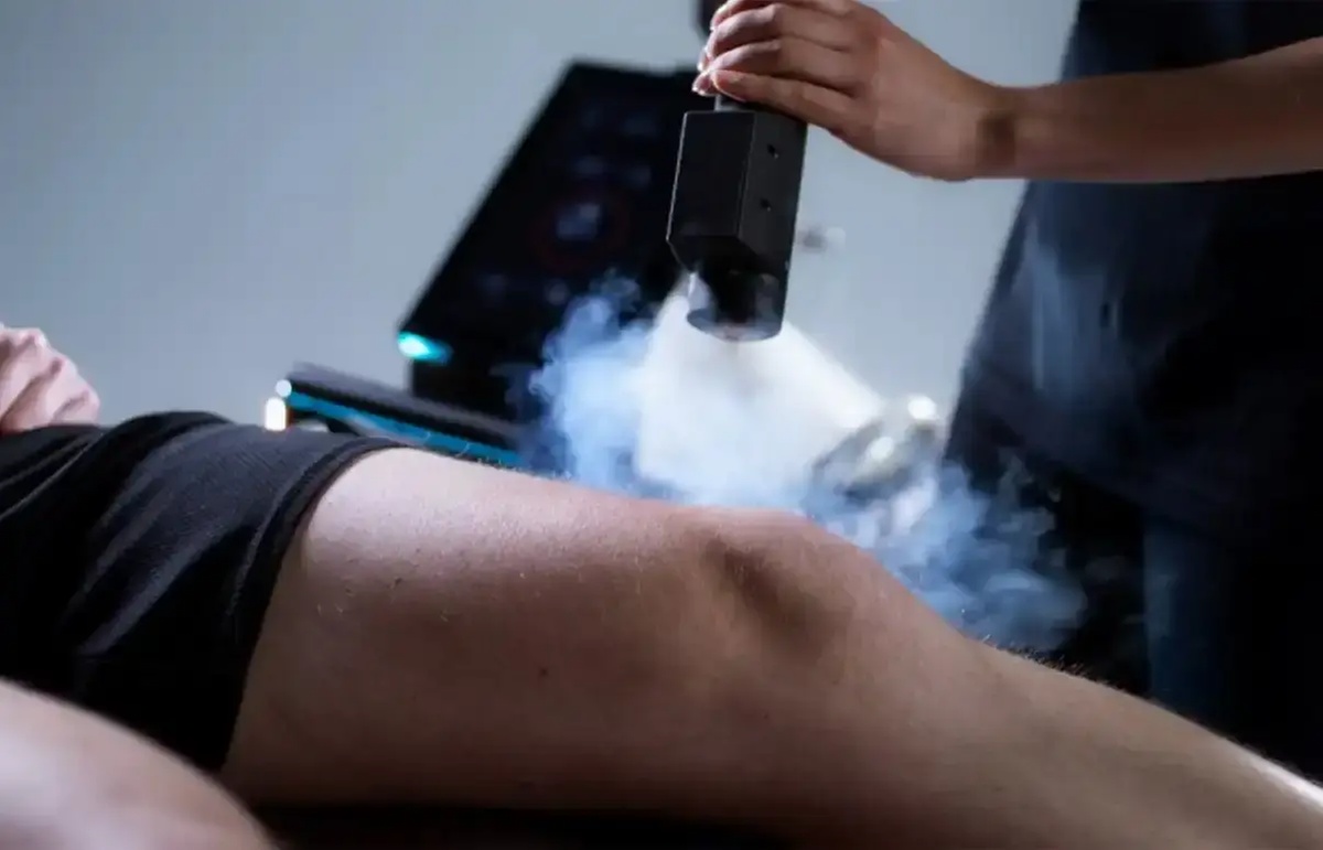 Localised Cryotherapy Sessions in Thanet: Drug-Free Pain Relief