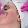 Image 1: Up to 53% Off on Micro-Needling at My Aesthetic Lounge
