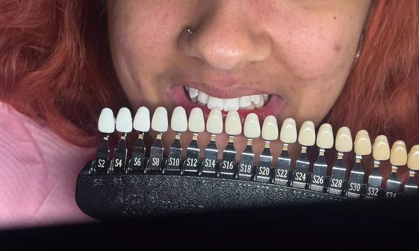 Teeth Whitening Sessions for a Radiantly Brighter Smile 