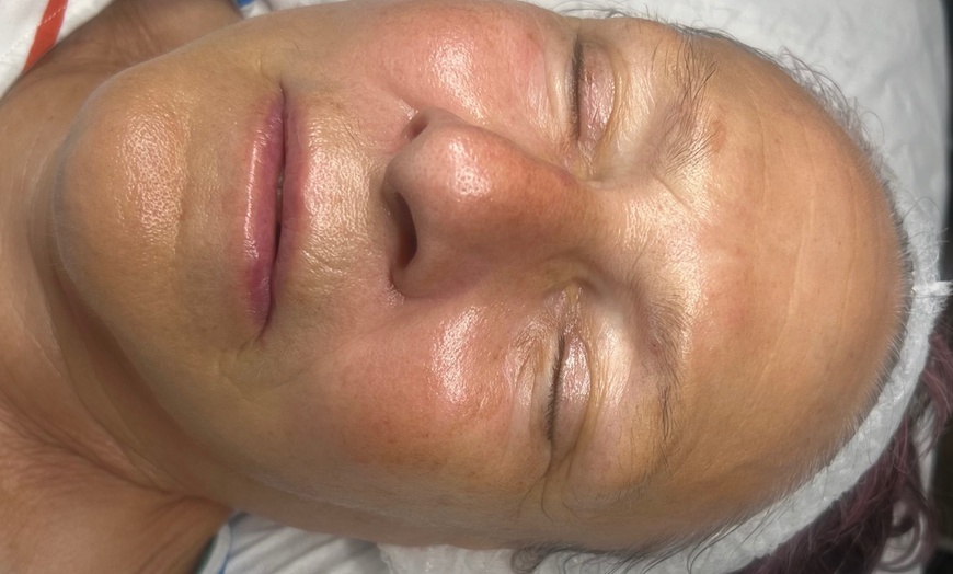 Image 4: Relax with a 60-Min Deep Cleanse Facial or Bye Peach Dermaplane Facial