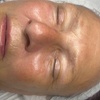 Image 4: Relax with a 60-Min Deep Cleanse Facial or Bye Peach Dermaplane Facial