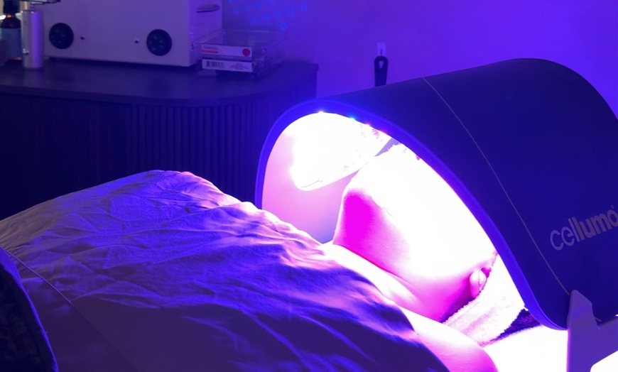 Image 2: 1,2 or 3 Dermaplane w/ HydroBoost, Brightening Peel + LED (75 mins)