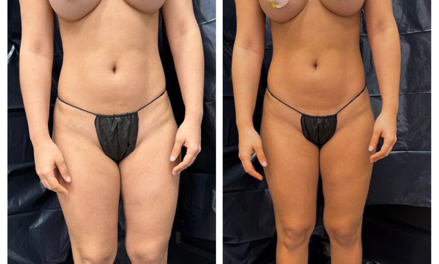 Image 3: Up to 56% Off on Spray Tanning at Nefertiti spa
