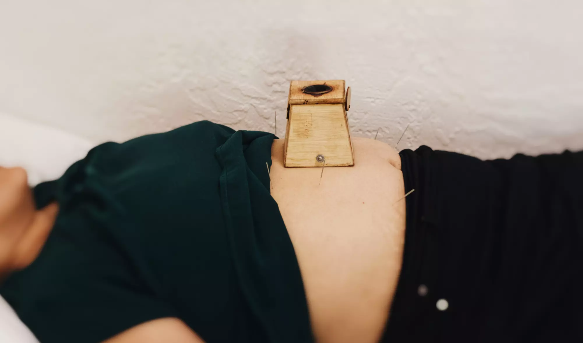 Rejuvenate Your Body: Cryotherapy, Acupuncture and More