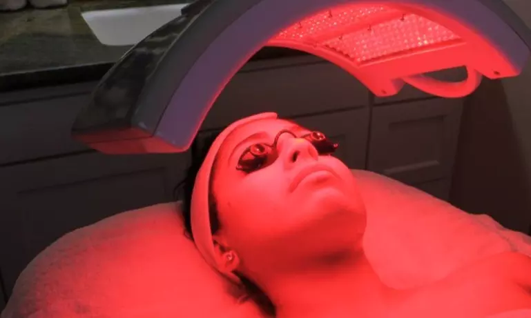 LED Laser, Glycolic Peel, Microdermabrasion, Collagen Treatment. It Takes One Hour and 20 Minutes - Primary Image