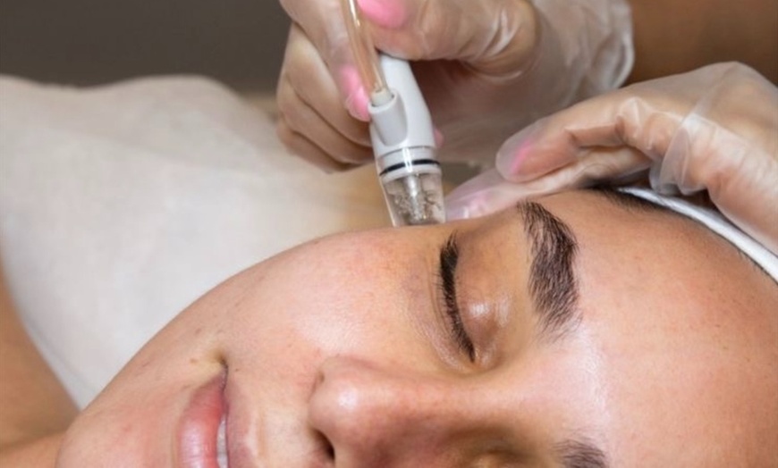 Image 1: One or Two Sessions of Hydra Dermabrasion with LED Therapy
