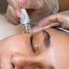 Image 1: One or Two Sessions of Hydra Dermabrasion with LED Therapy