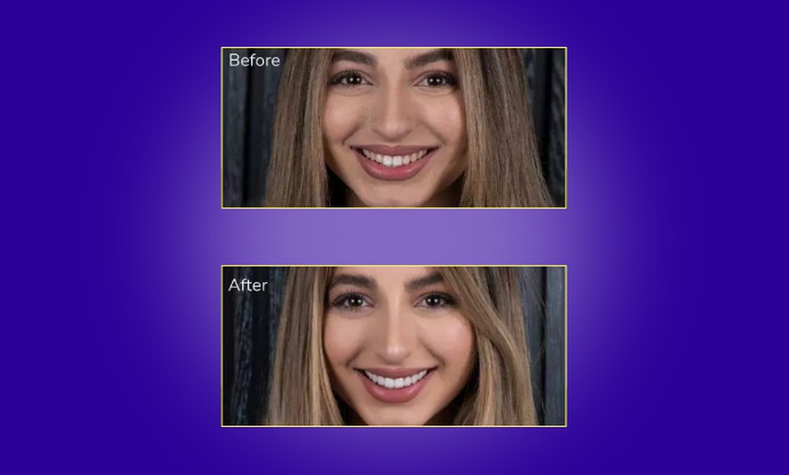 Image 2: Transform Your Smile with Custom Teeth Whitening