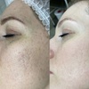 Image 3: Up to 70% Off on Facials at Euphoria Aesthetics