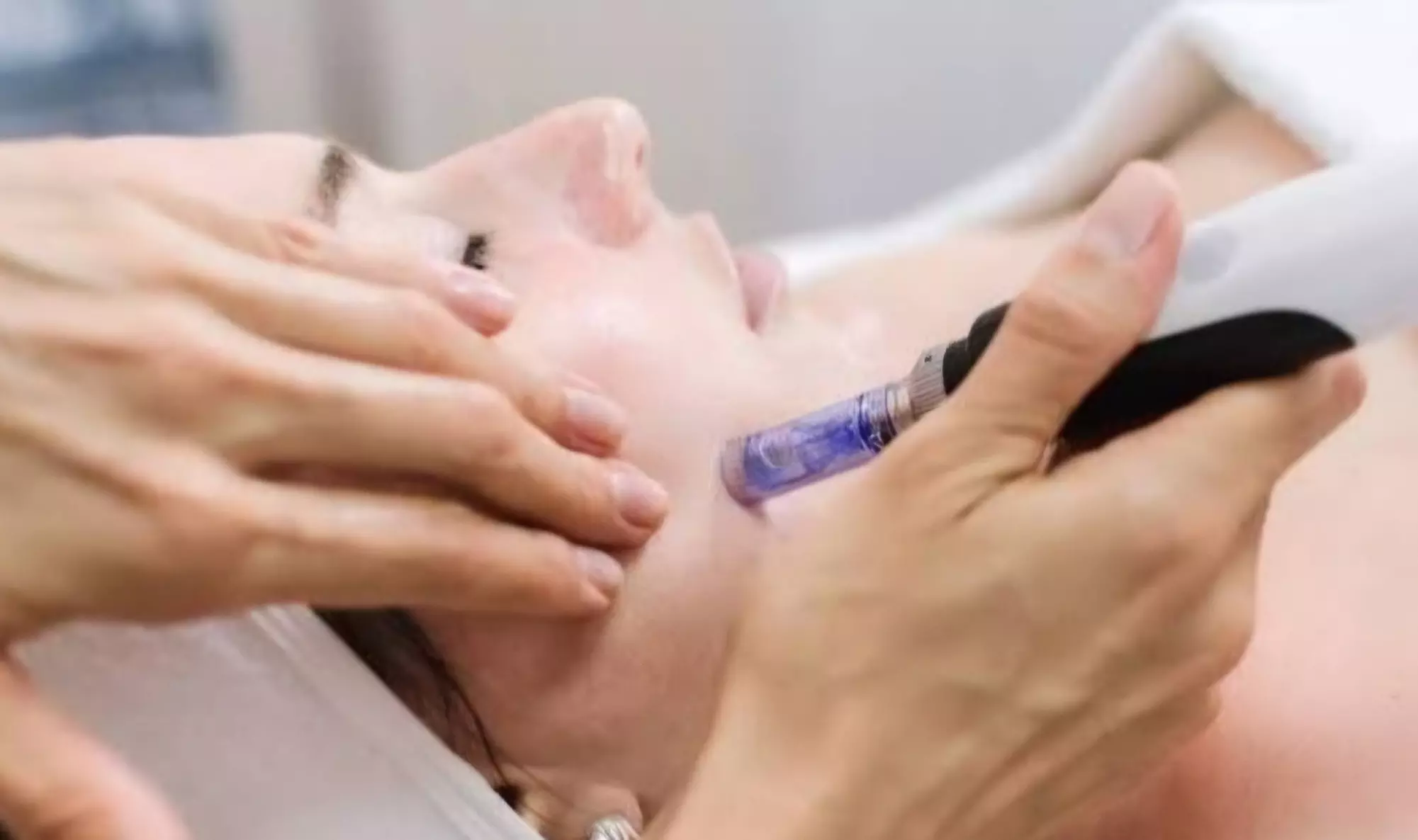 Head spa et du visage hydratation intense en option chez Dmbskin (jusqu'à 33% de remise) - Image 3