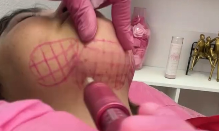 Image 3: Fat Dissolver at Pamper Me Pretty Day Spa