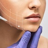Image 1: Achieve a Youthful Glow with PDO Thread Facelift