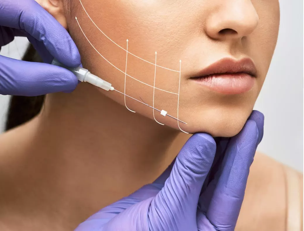 Achieve a Youthful Glow with PDO Thread Facelift