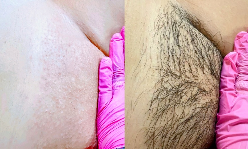 Image 4: One, Three, Five, or Ten 30-Minute Brazilian/Bikini Waxing Sessions 