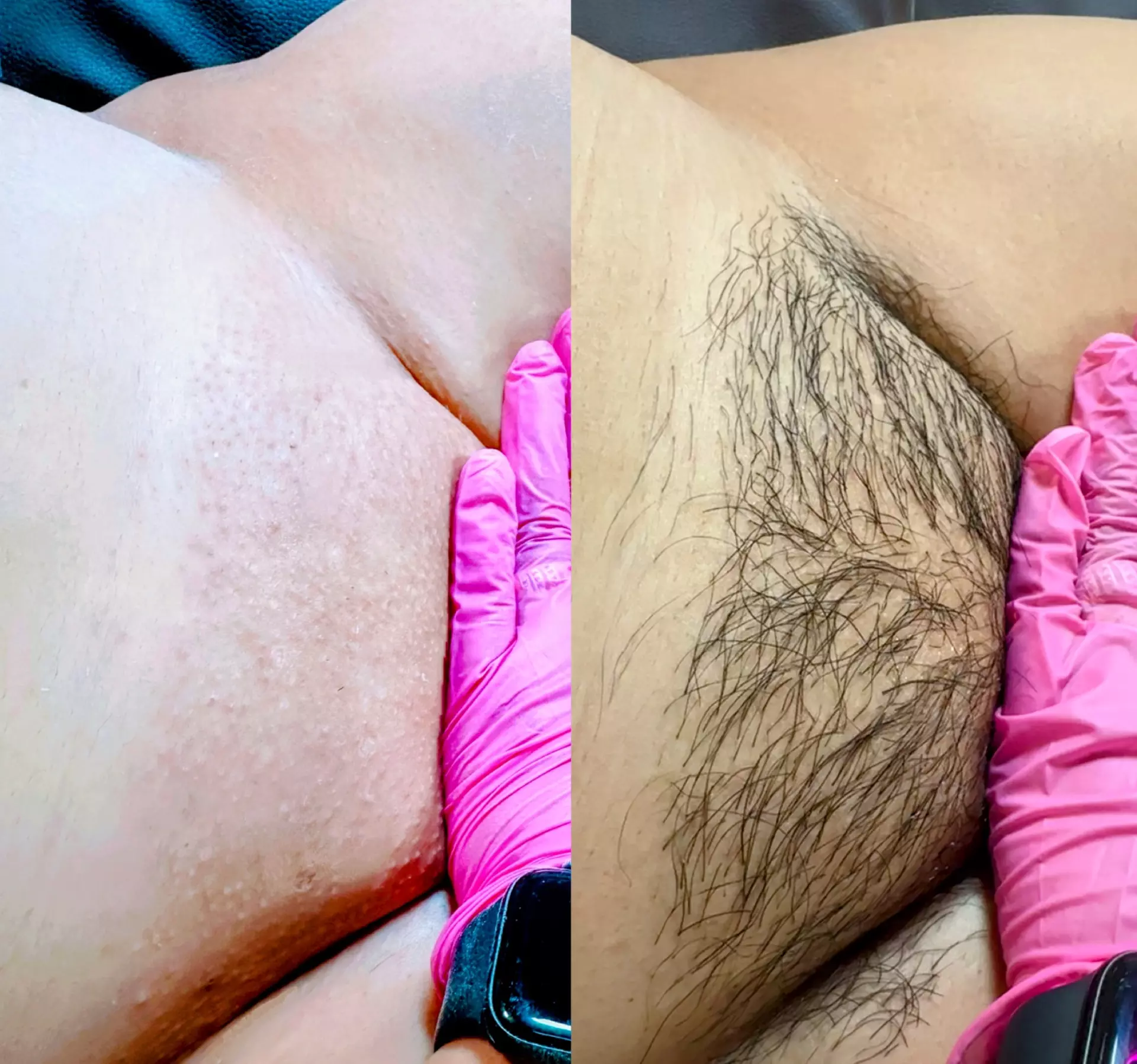 One, Three, Five, or Ten 30-Minute Brazilian/Bikini Waxing Sessions