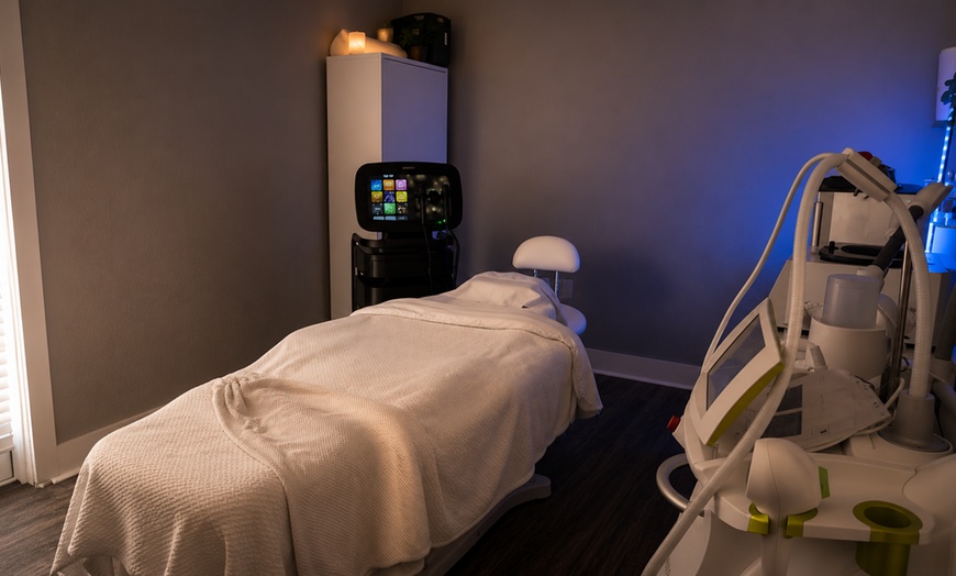 Image 4: Refresh Your Appearance with One, Three, or Five IPL Sessions (Face)