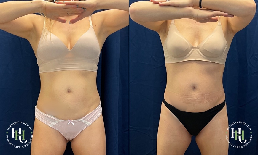 Image 8: Get EM Sculpt Abs/Buttocks/Thighs in Just 30 Minutes at Harmony In Health (Up to 74% Off)