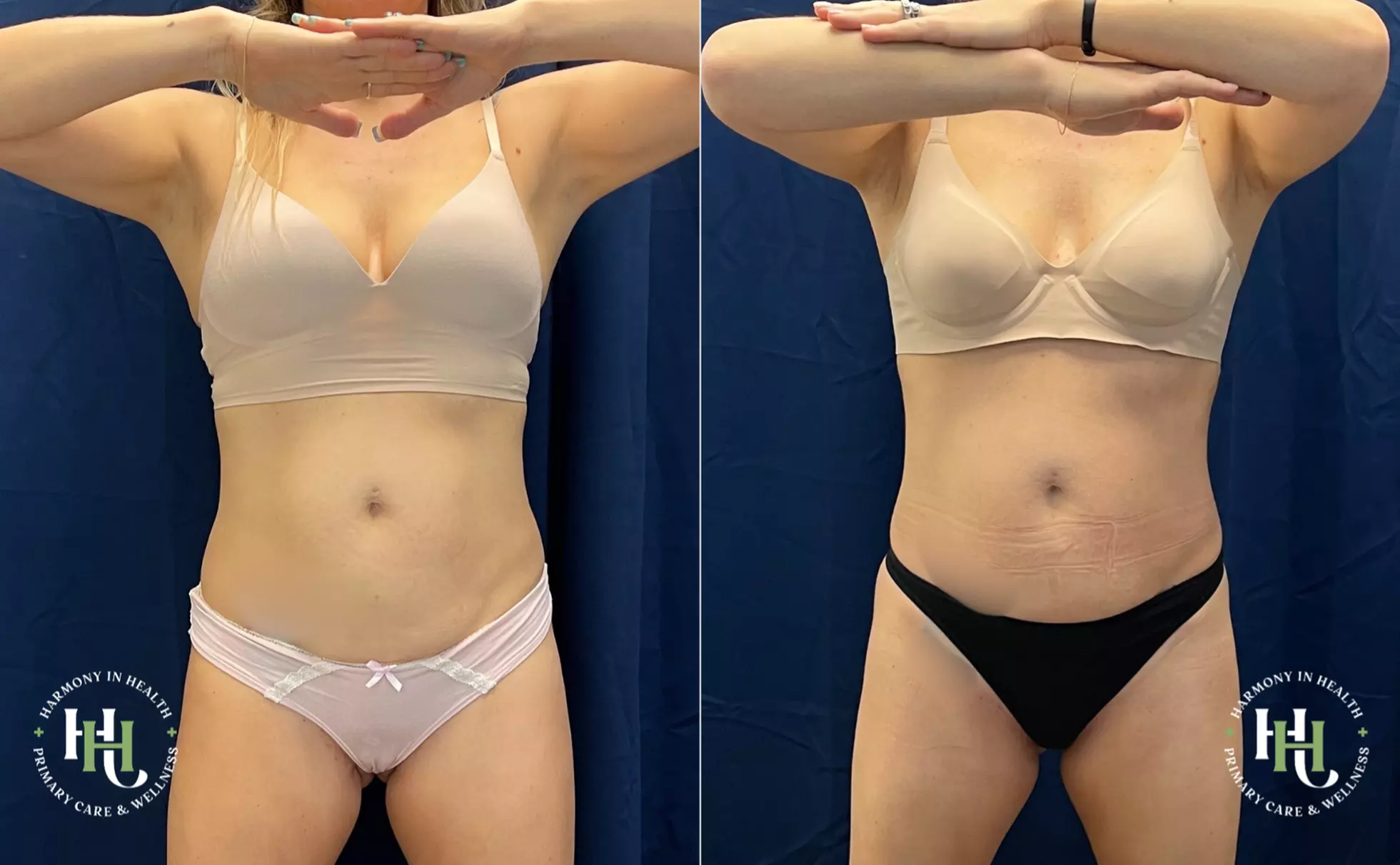 Get EMS Sculpt Abs/Buttocks/Thighs in Just 30 Minutes (Up to 74% Off)