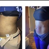Image 4: Single Session of BodyFX or MiniFX Fat Reduction and Skin Tightening