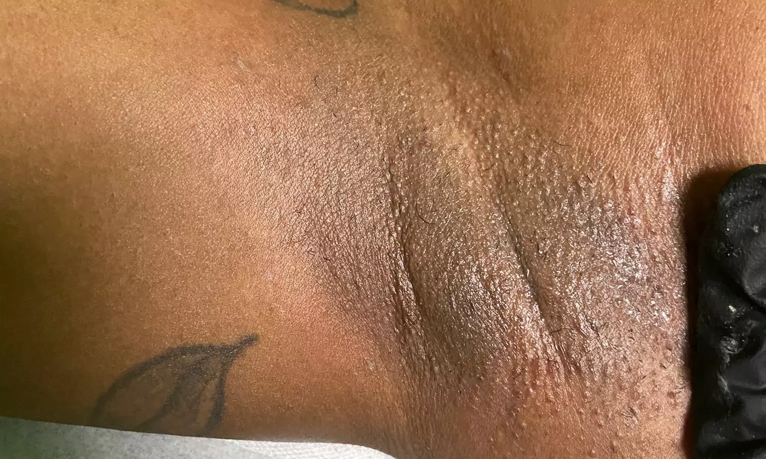 Smooth Skin Awaits with Waxing Services for Every Need